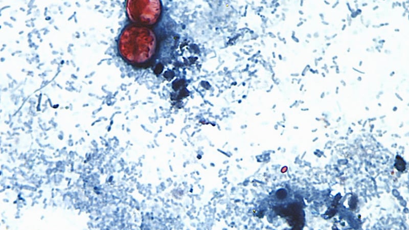 Esta fotografía tomada a través de un microscopio y difundida por los CDC muestra Cyclospora...