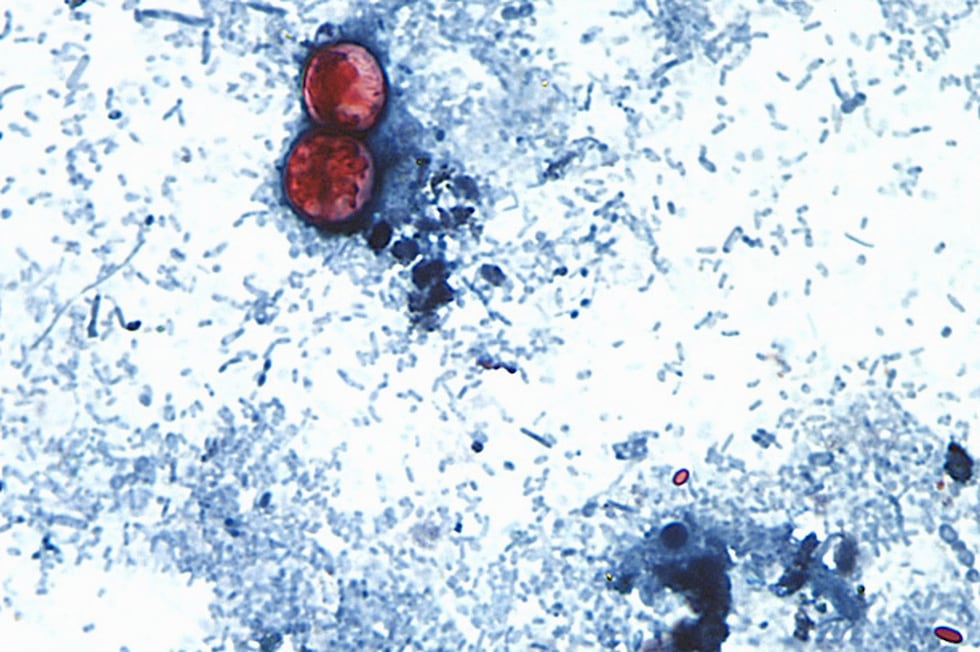 Esta fotografía tomada a través de un microscopio y difundida por los CDC muestra Cyclospora...