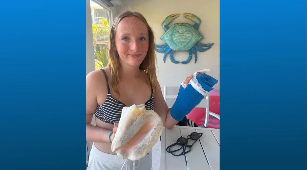Claire Macdonel, 13, was bitten by a barracuda while doing a handstand in shallow water at a...