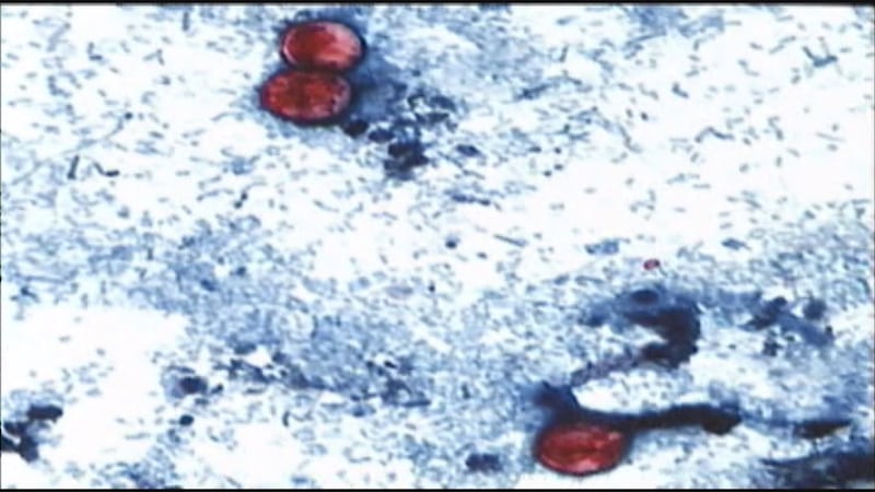 Cyclospora seen under a microscope. (Source: KLTV File Photo)
